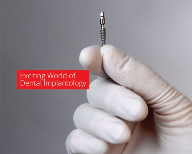 Dental implant courses in India